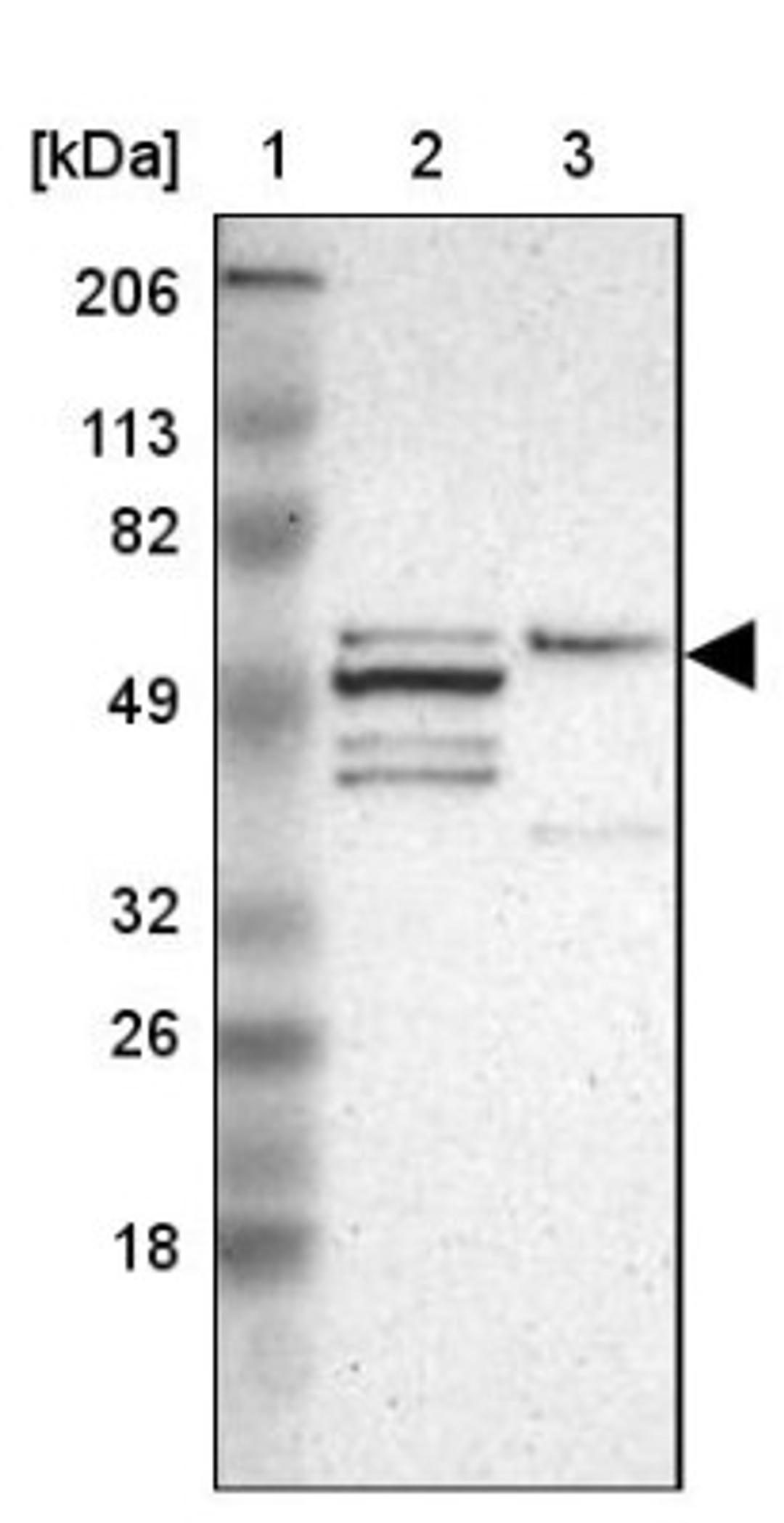 Western Blot: GLIS1 Antibody [NBP1-83492] - Lane 1: Marker [kDa] 206, 113, 82, 49, 32, 26, 18<br/>Lane 2: Human cell line RT-4<br/>Lane 3: Human cell line U-251MG sp