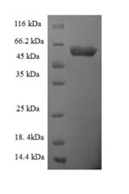 (Tris-Glycine gel) Discontinuous SDS-PAGE (reduced) with 5% enrichment gel and 15% separation gel.