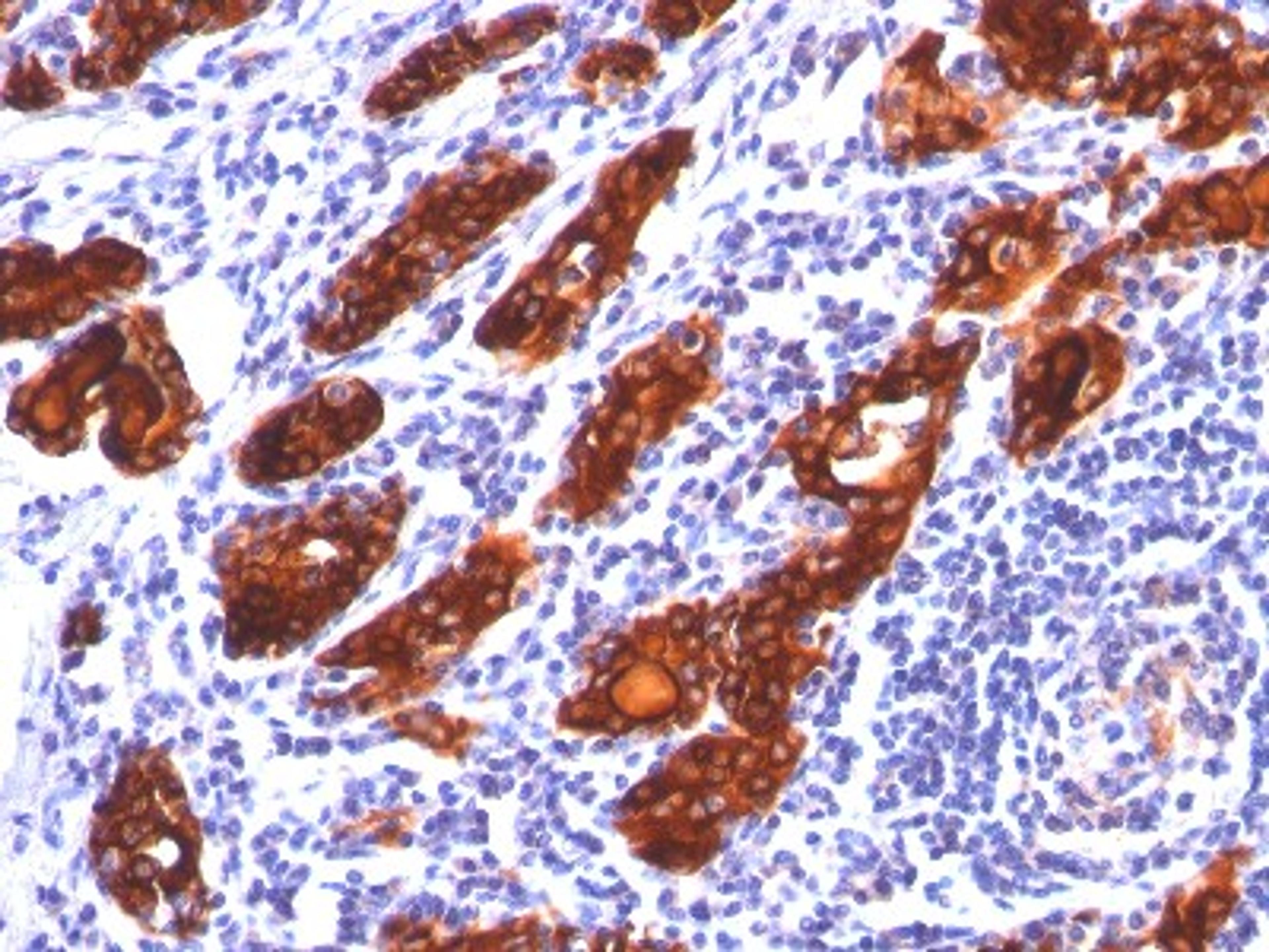 Immunohistochemistry-Paraffin: Thyroglobulin Antibody (SPM221) [NBP2-32904] - Formalin-paraffin thyroid stained with Thyroglobulin MAb (SPM221).