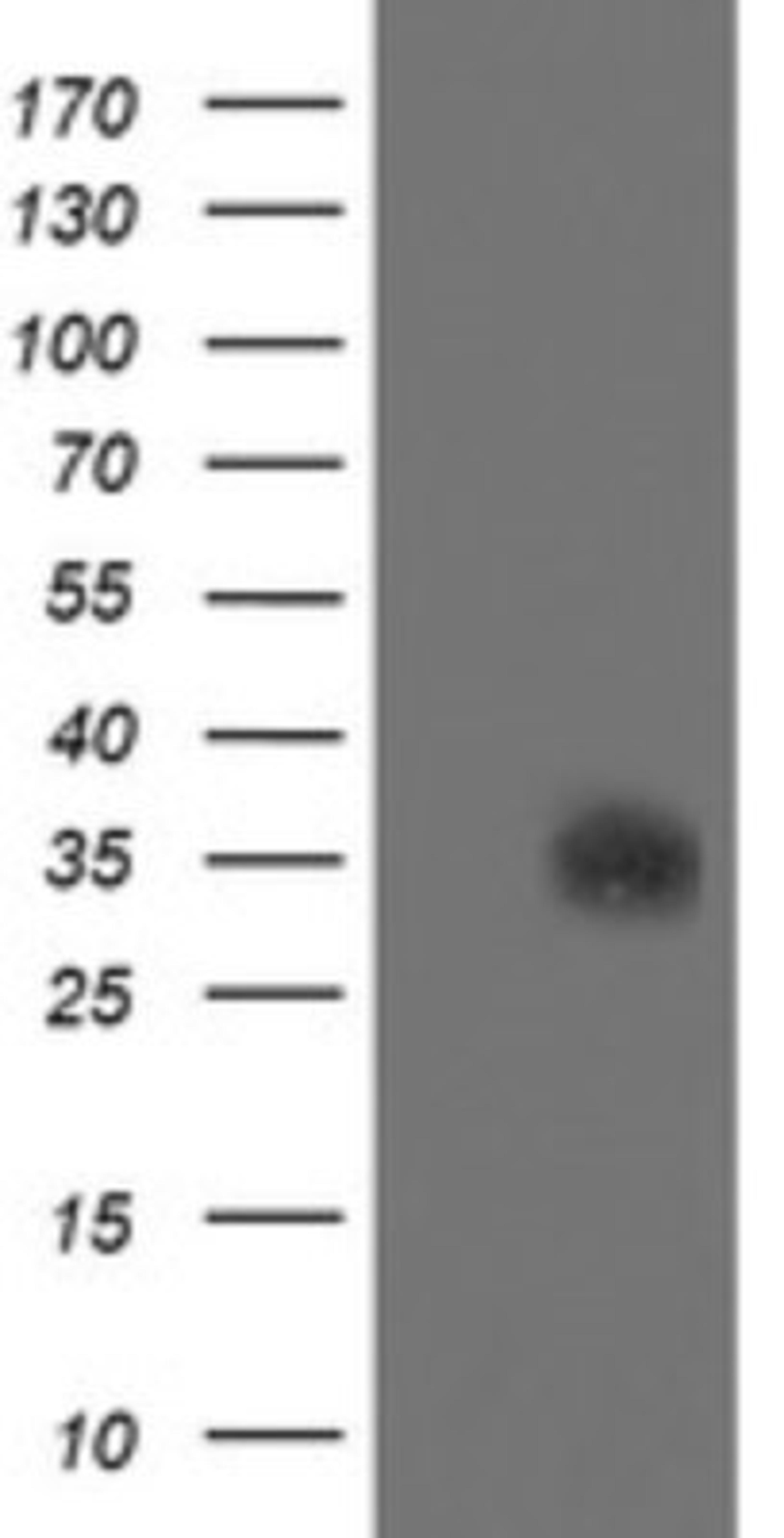 Western Blot: SDSL Antibody (1A8) [NBP2-45978] - Analysis of HEK293T cells were transfected with the pCMV6-ENTRY control (Left lane) or pCMV6-ENTRY SDSL.