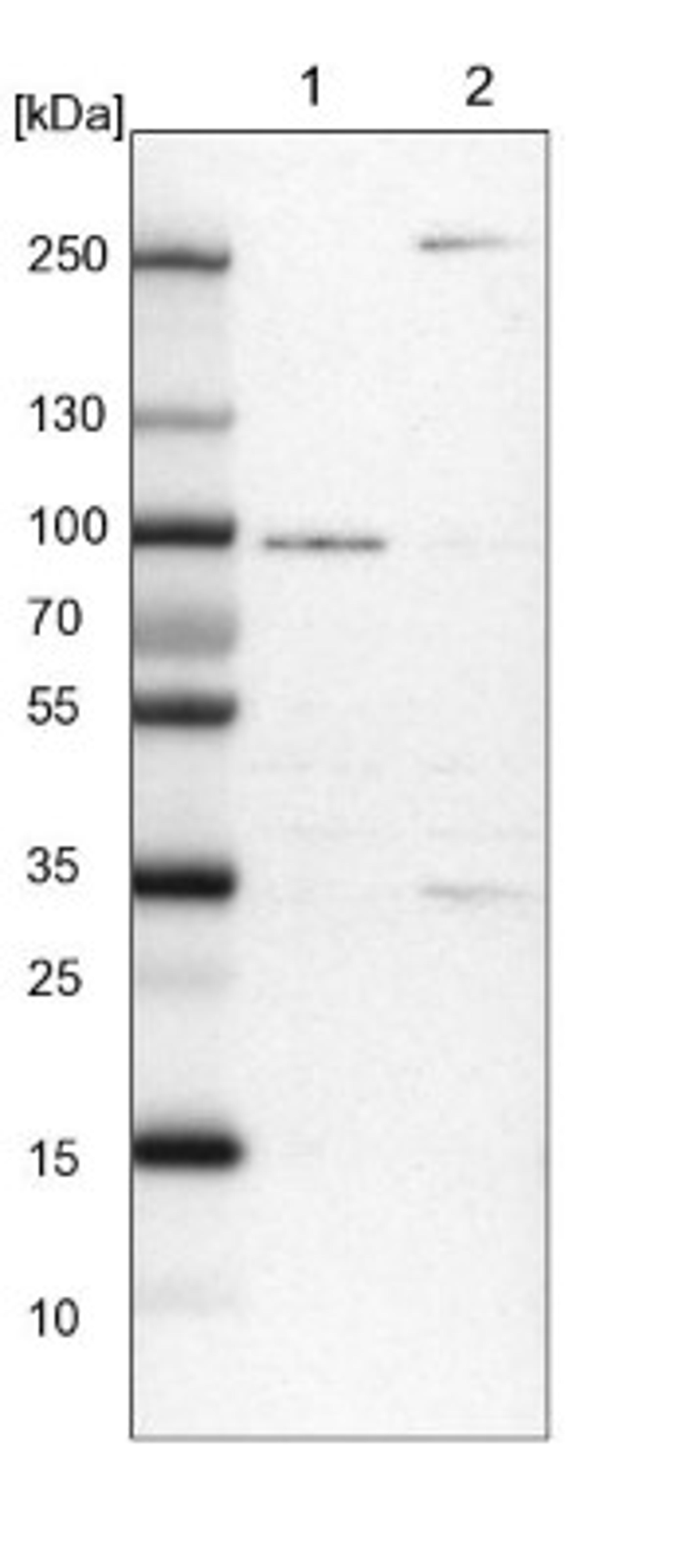 Western Blot: RUSC1 Antibody [NBP1-81005] - Lane 1: NIH-3T3 cell lysate (Mouse embryonic fibroblast cells)<br/>Lane 2: NBT-II cell lysate (Rat Wistar bladder tumour cells)