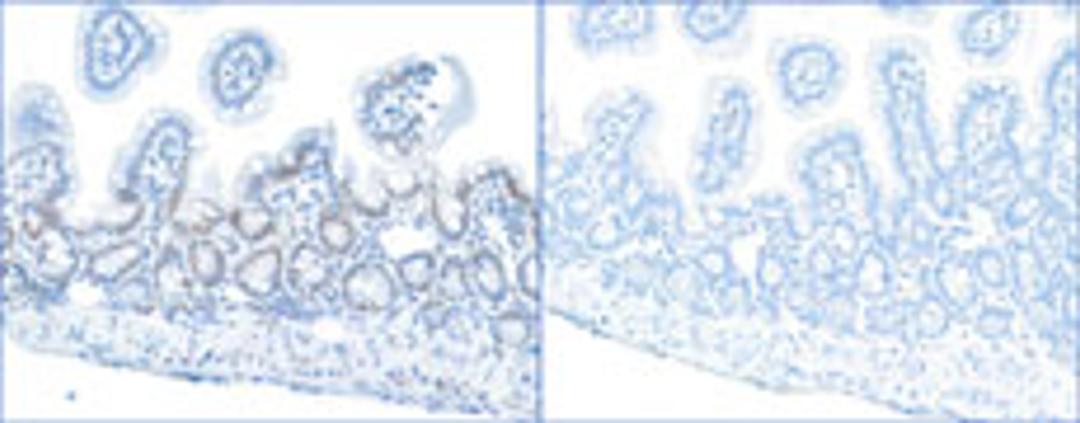 Detection of mouse Phospho RPA32 (S4/S8) by immunohistochemistry.