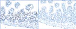 Detection of mouse Phospho RPA32 (S4/S8) by immunohistochemistry.