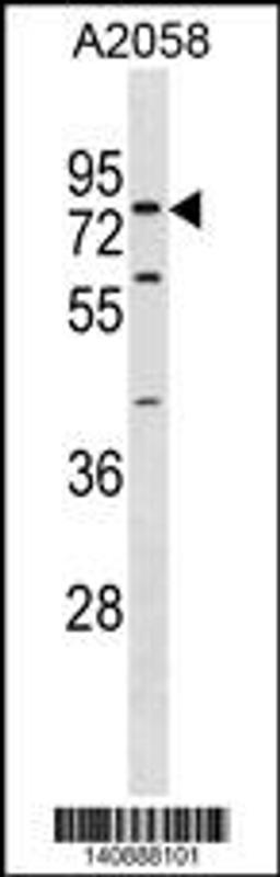 Western blot analysis in A2058 cell line lysates (35ug/lane).