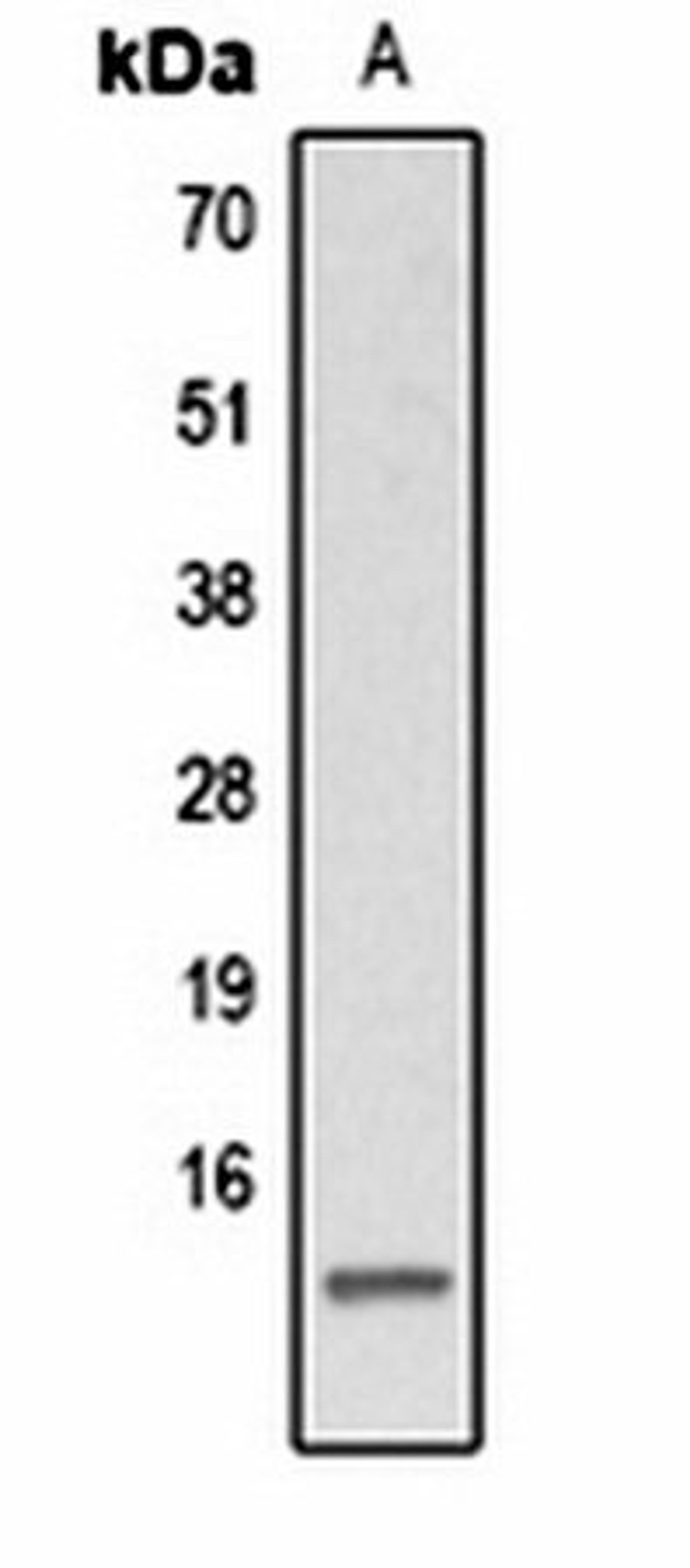 Western blot analysis of  Hela TSA-treated (Lane1) whole cell lysates using Histone H2A (AcK15) antibody