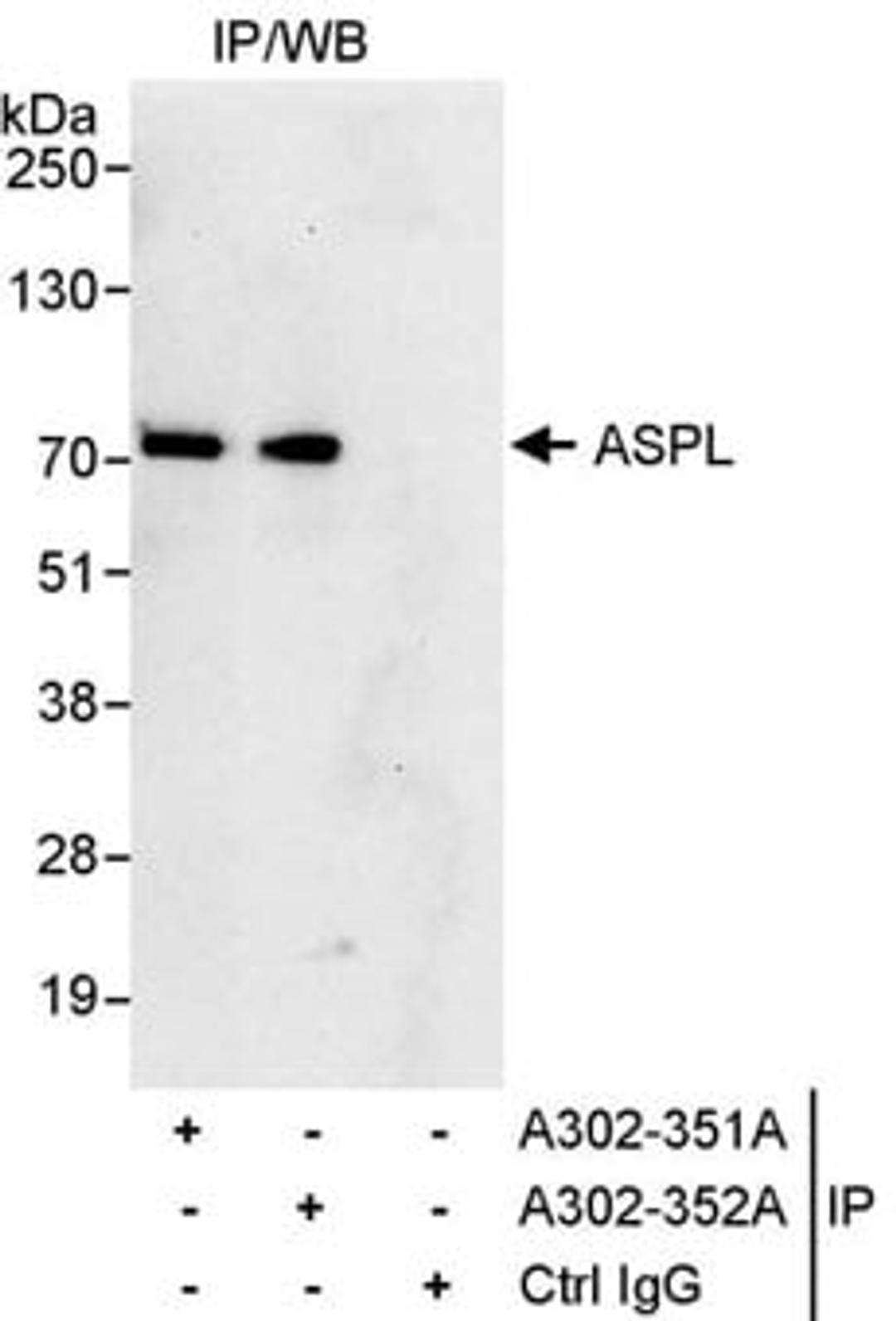 Detection of human ASPL by western blot of immunoprecipitates.