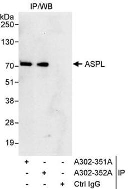 Detection of human ASPL by western blot of immunoprecipitates.