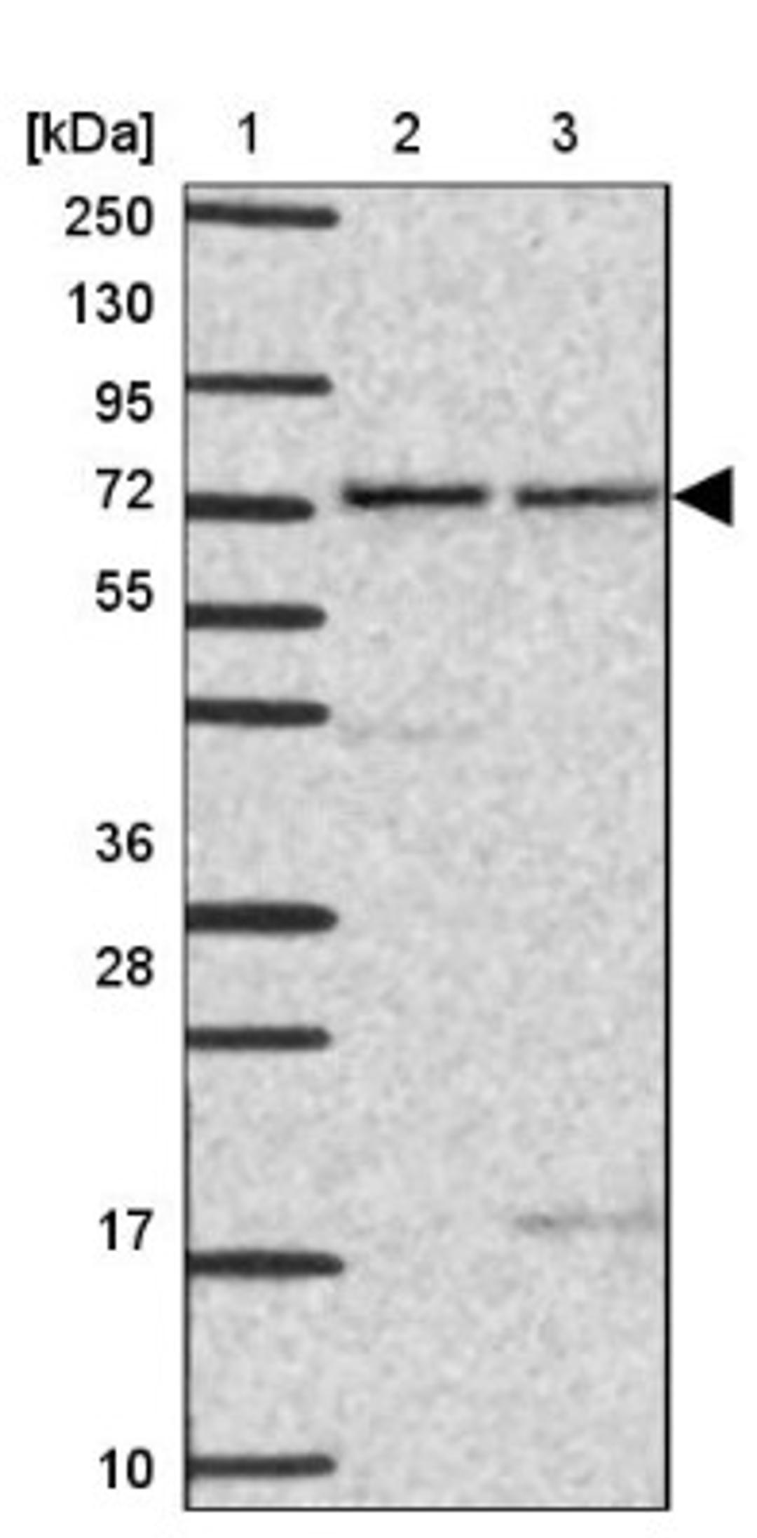 Western Blot: SYNPO2L Antibody [NBP2-33741] - Lane 1: Marker [kDa] 250, 130, 95, 72, 55, 36, 28, 17, 10<br/>Lane 2: Human cell line RT-4<br/>Lane 3: Human cell line U-251MG sp