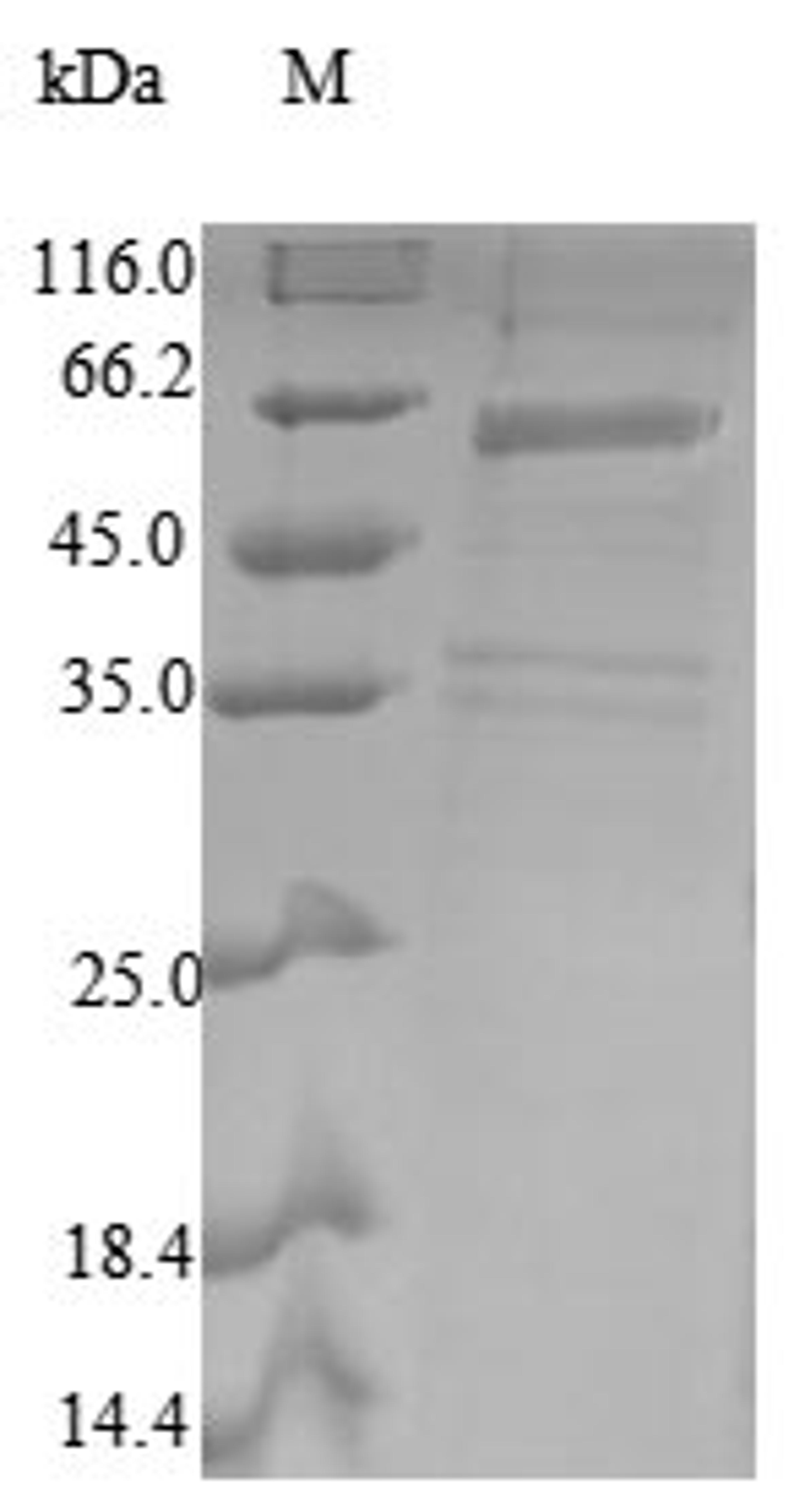 (Tris-Glycine gel) Discontinuous SDS-PAGE (reduced) with 5% enrichment gel and 15% separation gel.