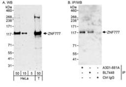 Detection of human ZNF777 by western blot and immunoprecipitation.