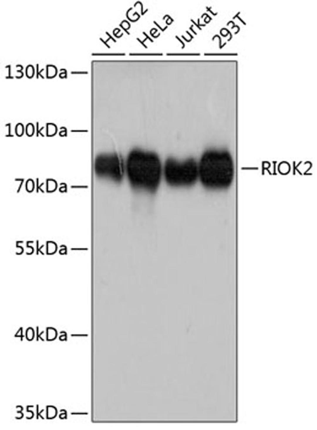 Western blot - RIOK2 antibody (A12122)