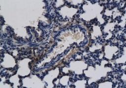 Immunohistochemical staining of paraffin embedded rat lung tissue using FGF8 antibody