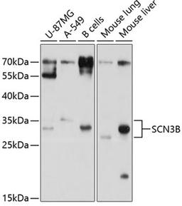 Western blot - SCN3B antibody (A10316)