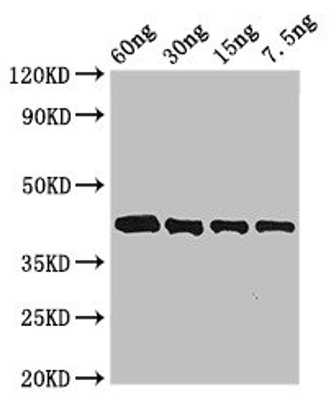 Western Blot. Positive WB detected in Recombinant protein. All lanes: Arginine esterase antibody at 3µg/ml. Secondary. Goat polyclonal to rabbit IgG at 1/50000 dilution. predicted band size: 42 kDa. observed band size: 42 kDa