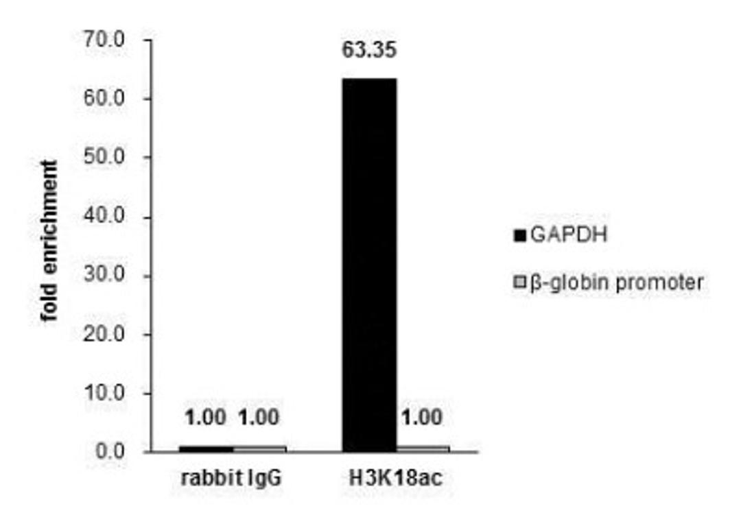 Chromatin Immunoprecipitation: HIST1H3A [ac Lys18] Antibody [NBP2-43535] - Cross-linked ChIP was performed with HeLa chromatin extract treated with Trichostatin A (0.4 uM for 18 h) and 5 ug of either control rabbit IgG or anti-Histone H3K18ac (acetyl Lys18) antibody. The precipitated DNA was detected by PCR with primer set targeting to GAPDH or beta-globin promoter.