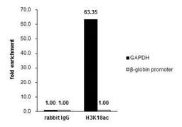 Chromatin Immunoprecipitation: HIST1H3A [ac Lys18] Antibody [NBP2-43535] - Cross-linked ChIP was performed with HeLa chromatin extract treated with Trichostatin A (0.4 uM for 18 h) and 5 ug of either control rabbit IgG or anti-Histone H3K18ac (acetyl Lys18) antibody. The precipitated DNA was detected by PCR with primer set targeting to GAPDH or beta-globin promoter.