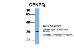 Western Blot: CENPQ Antibody [NBP1-55216] - Human Fetal Muscle, Antibody Dilution: 1.0 ug/ml.