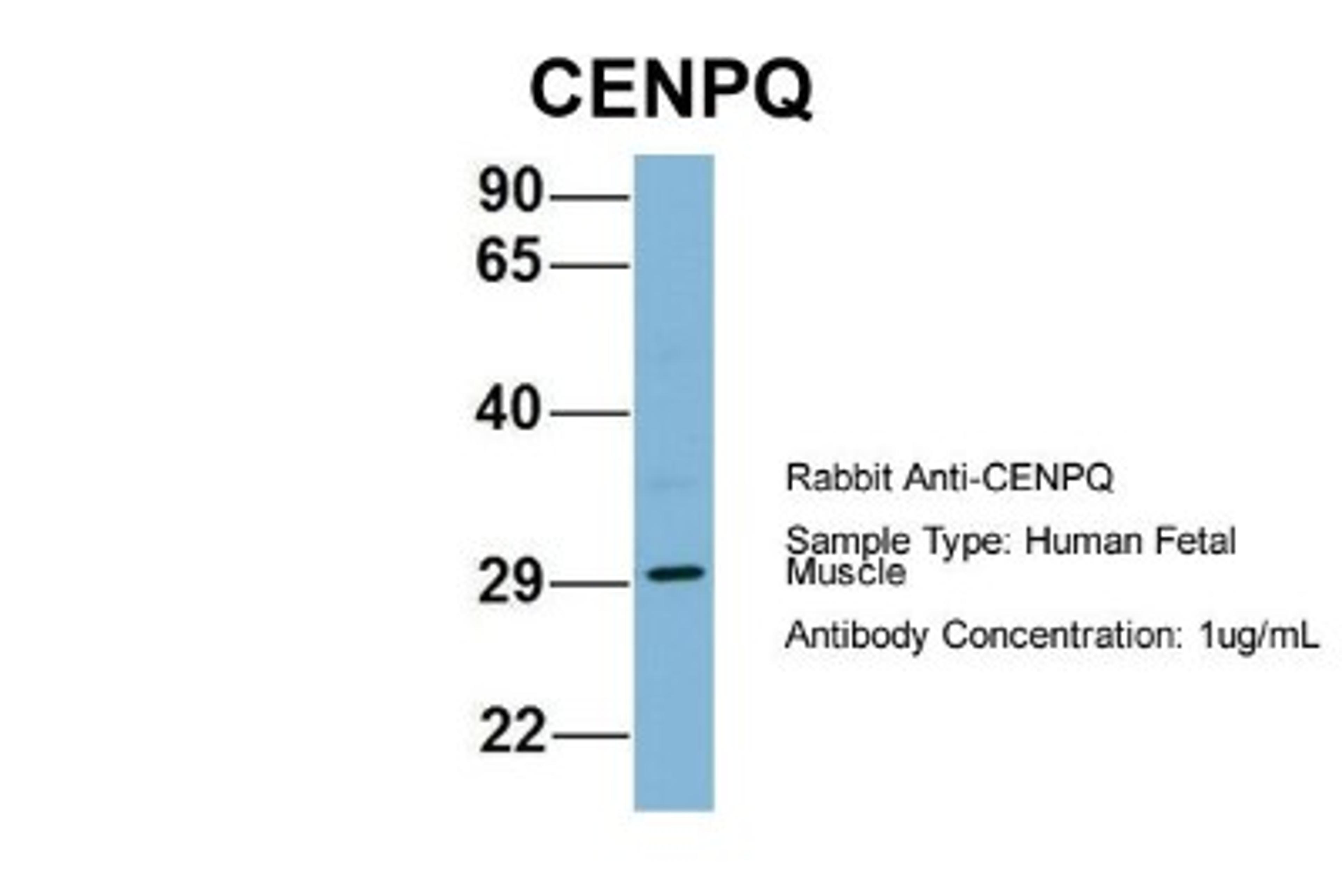 Western Blot: CENPQ Antibody [NBP1-55216] - Human Fetal Muscle, Antibody Dilution: 1.0 ug/ml.