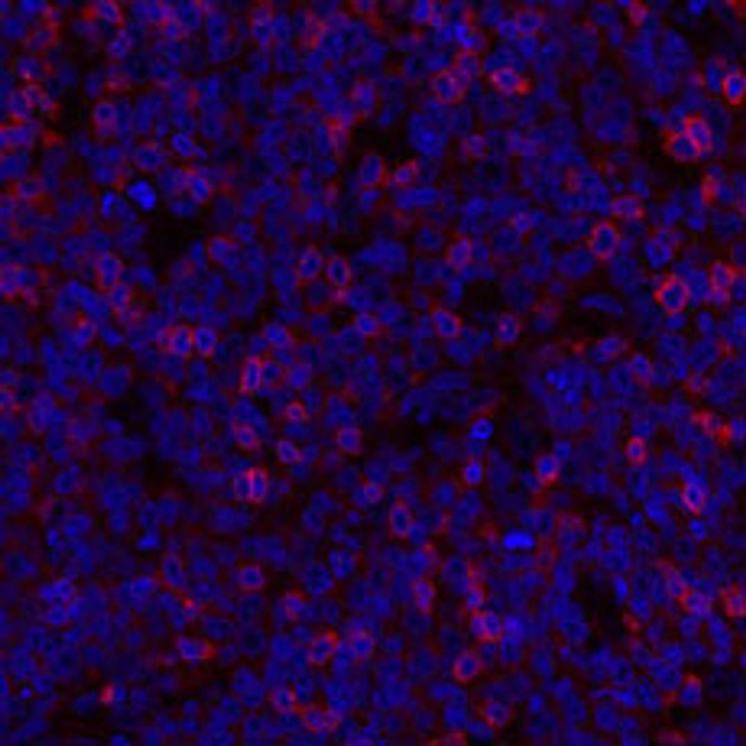 Detection of human TIGIT (red) in immunohistochemistry.