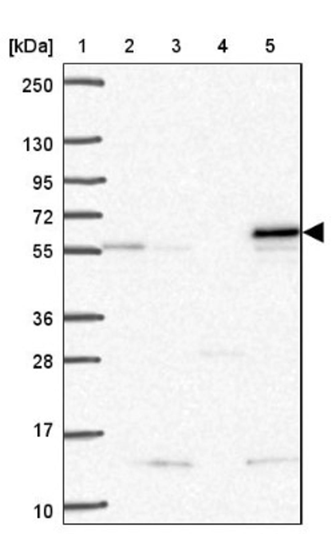 Western Blot: SARS2 Antibody [NBP2-33807] - Lane 1: Marker [kDa] 250, 130, 95, 72, 55, 36, 28, 17, 10<br/>Lane 2: Human cell line RT-4<br/>Lane 3: Human cell line U-251MG sp<br/>Lane 4: Human plasma (IgG/HSA depleted)<br/>Lane 5: Human liver tissue