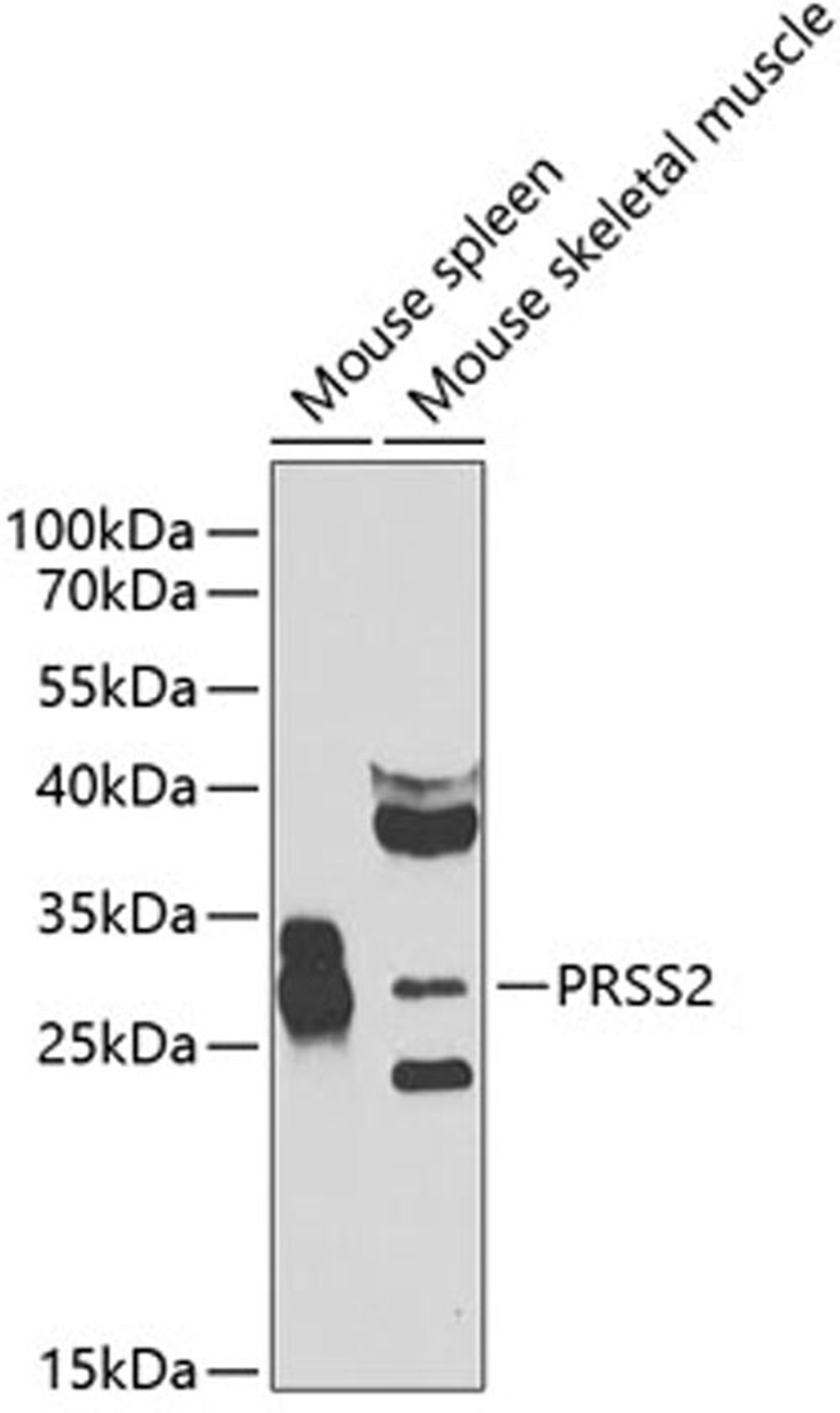 Western blot - PRSS2 antibody (A7923)