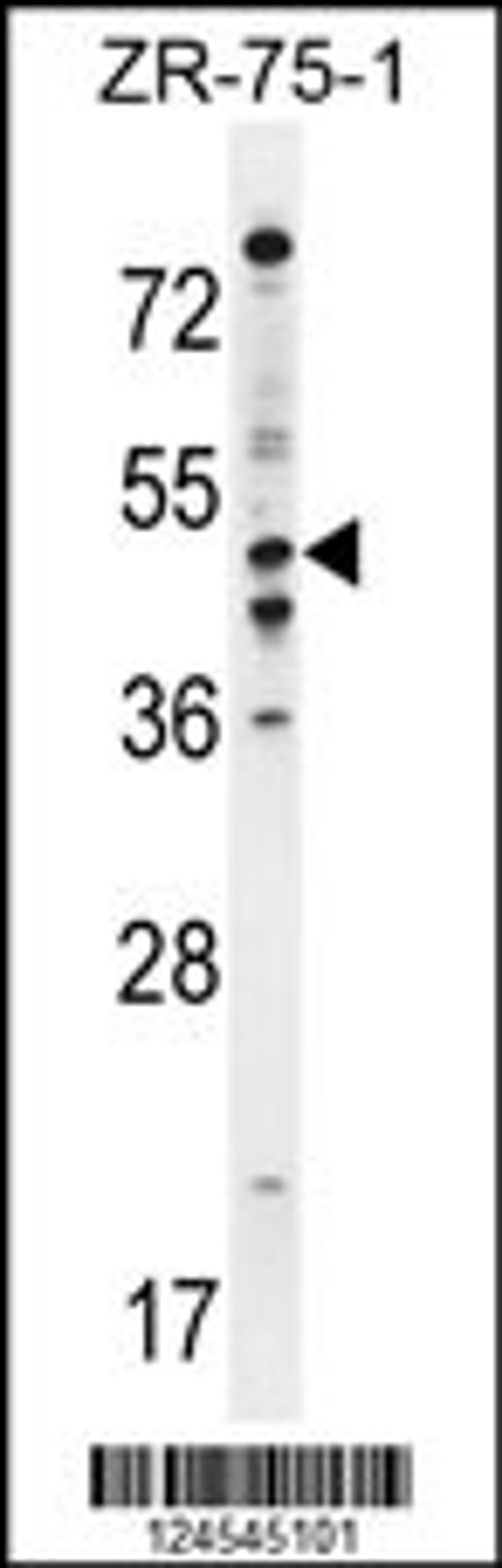 Western blot analysis in ZR-75-1 cell line lysates (35ug/lane).