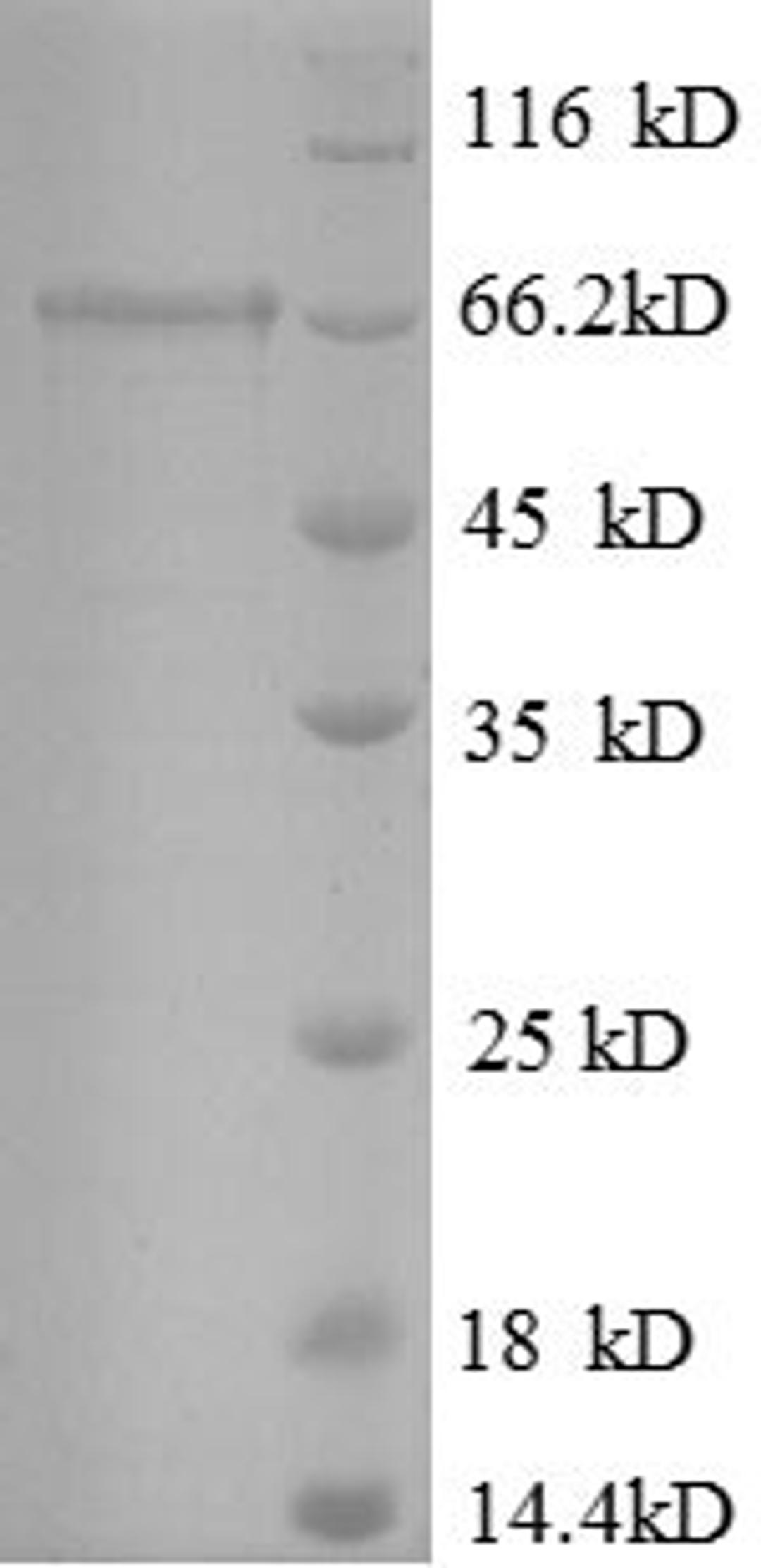 (Tris-Glycine gel) Discontinuous SDS-PAGE (reduced) with 5% enrichment gel and 15% separation gel.