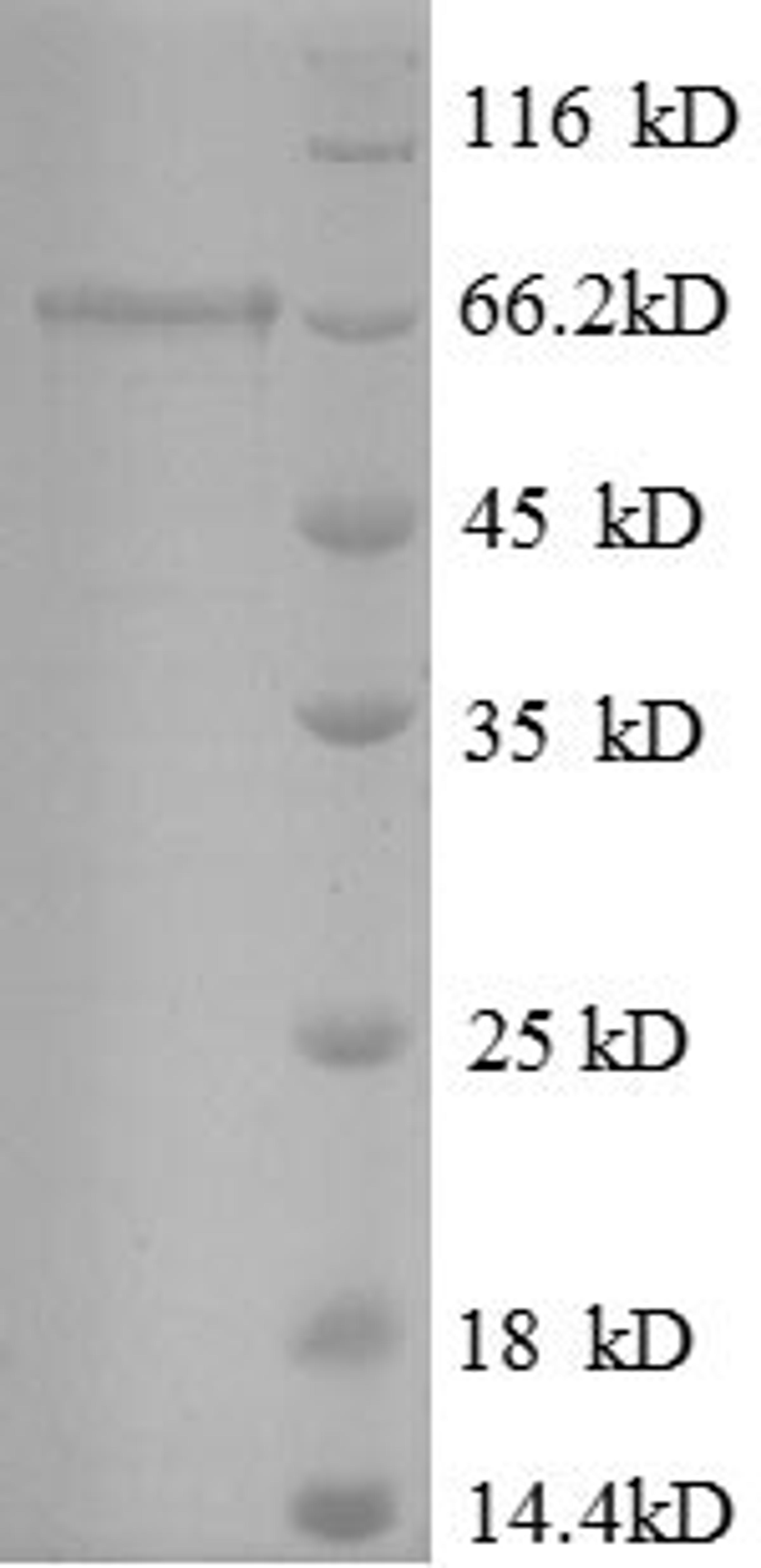 (Tris-Glycine gel) Discontinuous SDS-PAGE (reduced) with 5% enrichment gel and 15% separation gel.