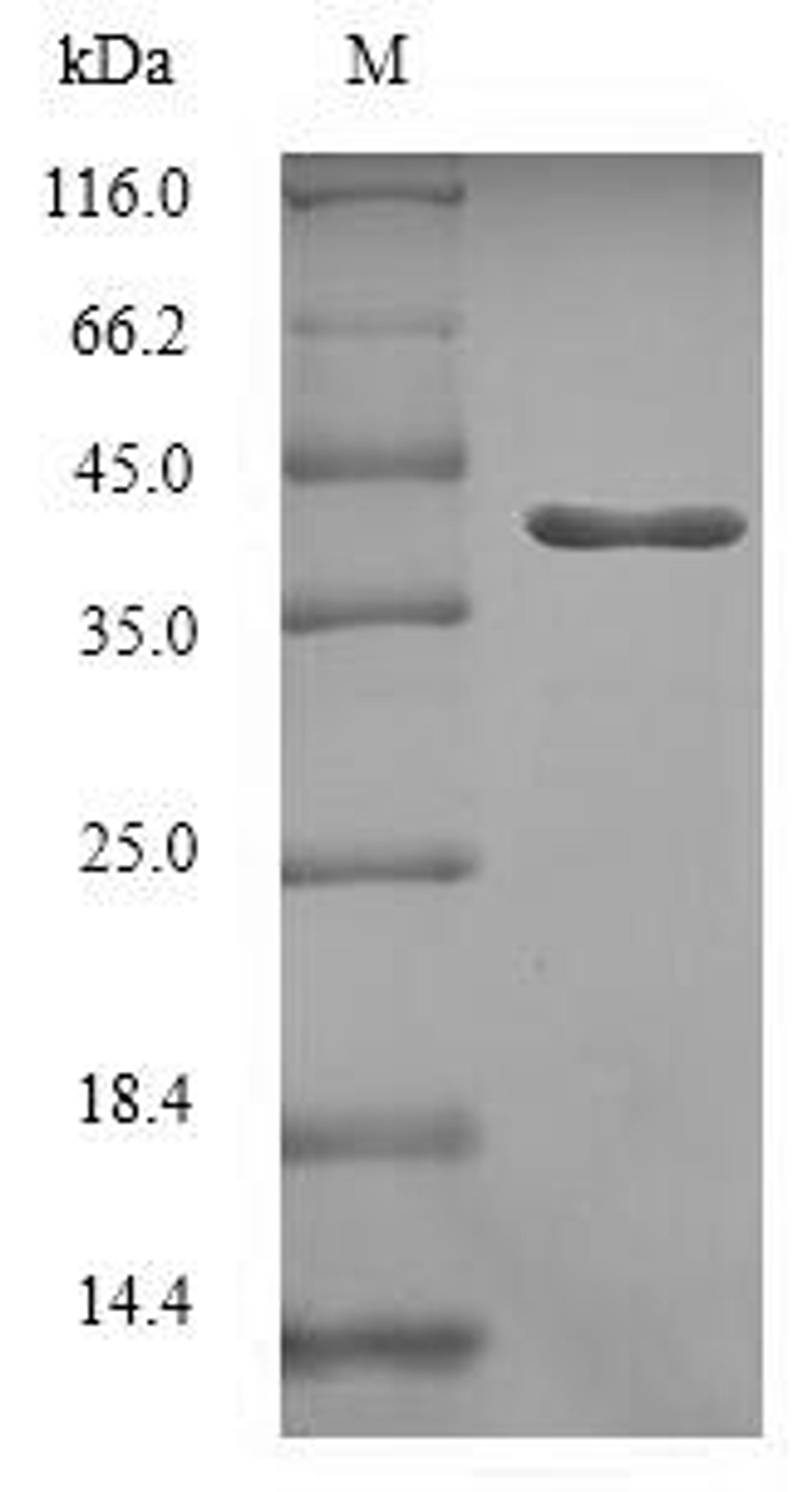 (Tris-Glycine gel) Discontinuous SDS-PAGE (reduced) with 5% enrichment gel and 15% separation gel.