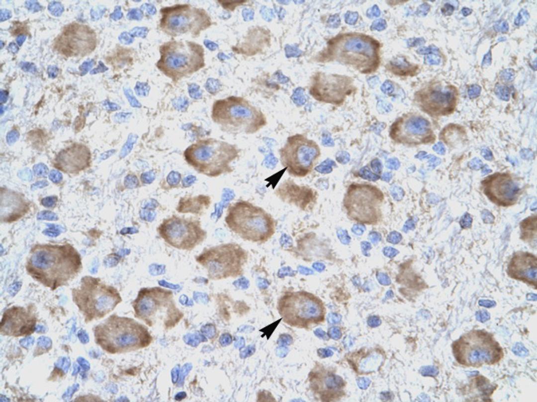 Antibody used in IHC on Human Brain.