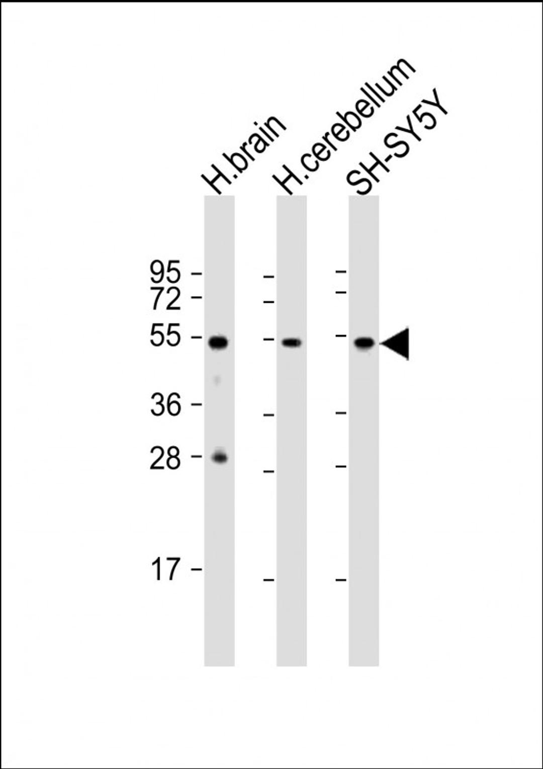 Western Blot at 1:1000 dilution Lane 1: human brain lysate Lane 2: human cerebellum lysate Lane 3: SH-SY5Y whole cell lysate Lysates/proteins at 20 ug per lane.