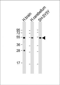 Western Blot at 1:1000 dilution Lane 1: human brain lysate Lane 2: human cerebellum lysate Lane 3: SH-SY5Y whole cell lysate Lysates/proteins at 20 ug per lane.