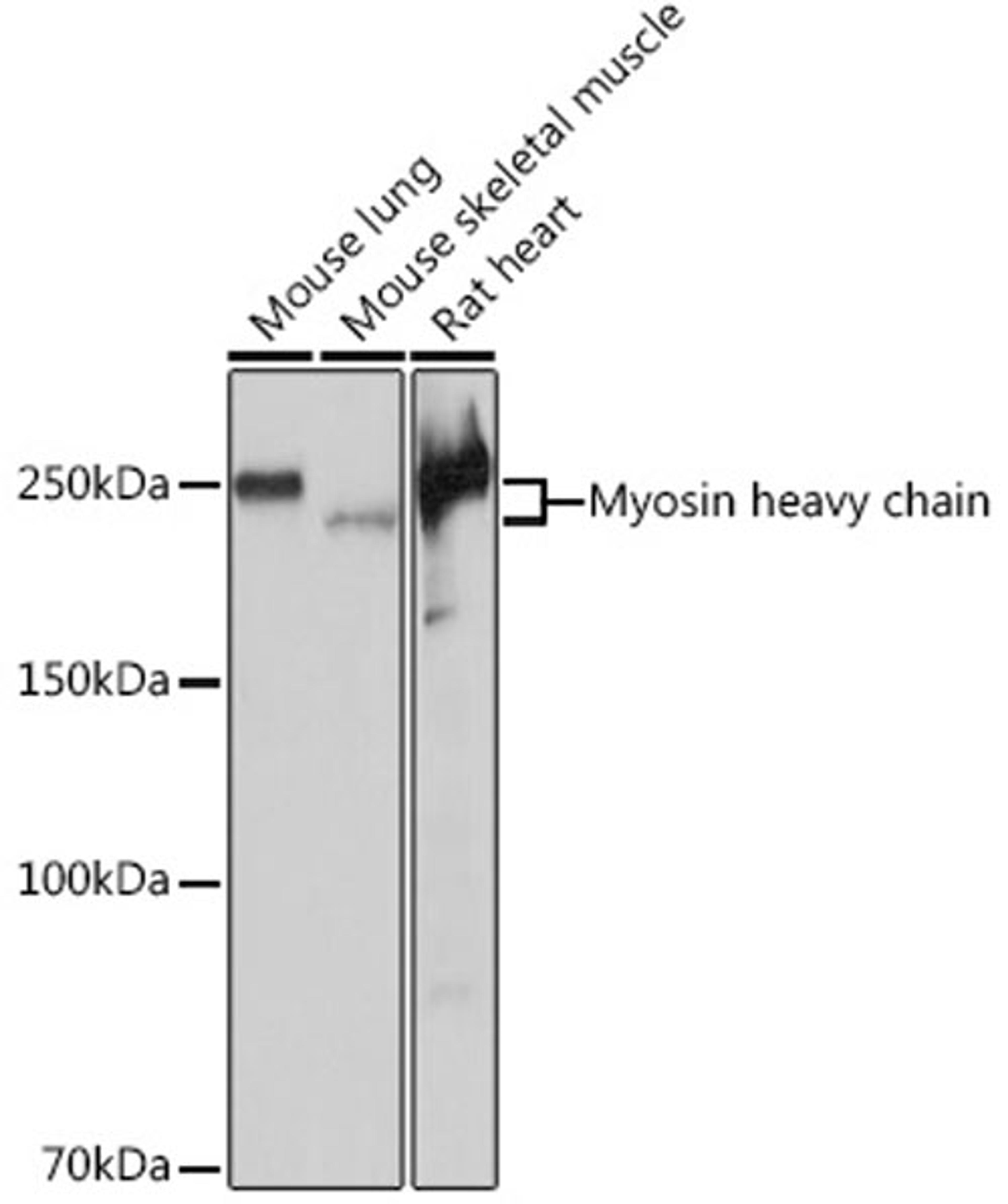 Western blot - Myosin heavy chain Rabbit mAb (A4963)