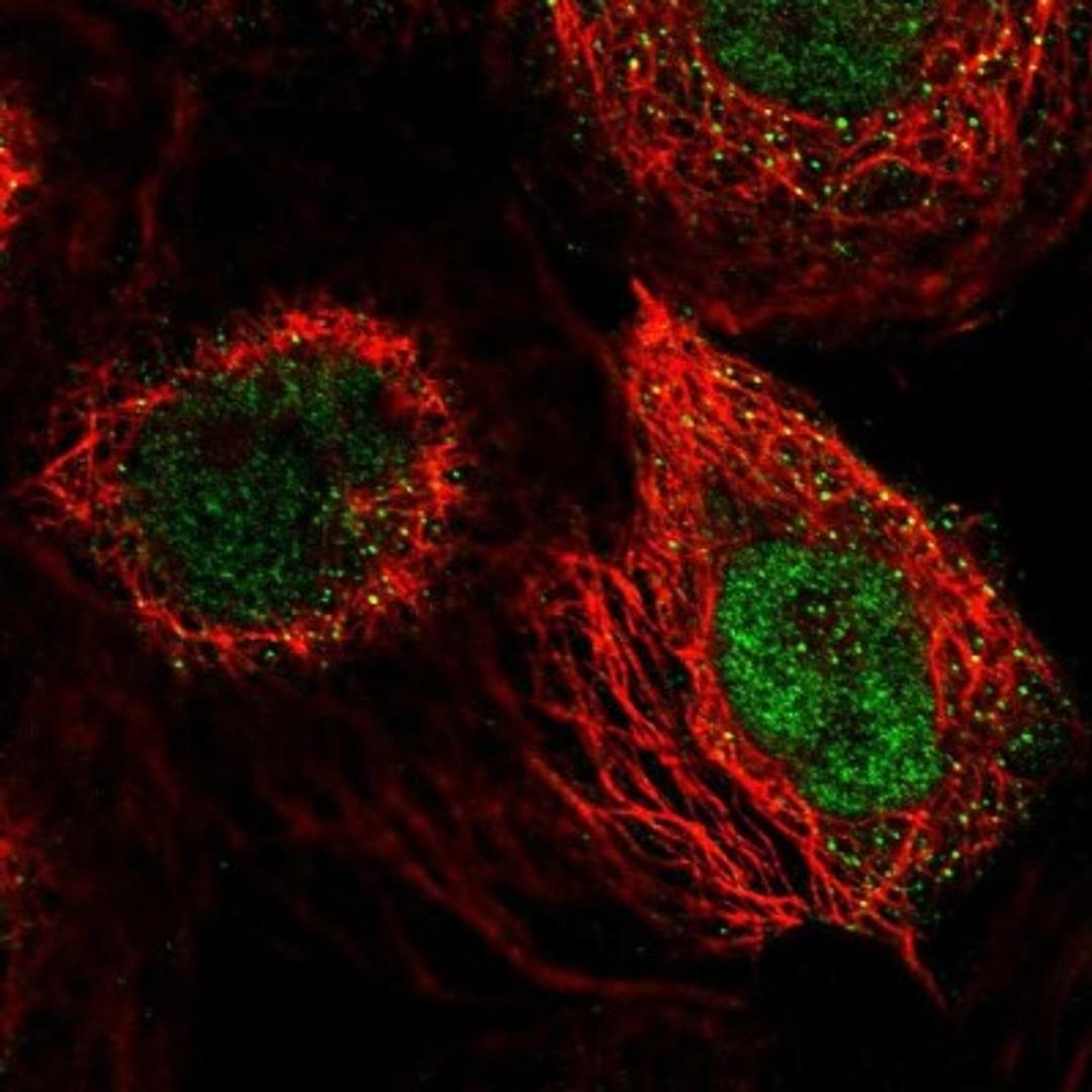 Immunocytochemistry/Immunofluorescence: SLFN5 Antibody [NBP1-81178] - Staining of human cell line A-431 shows positivity in nuclei but not nucleoli.