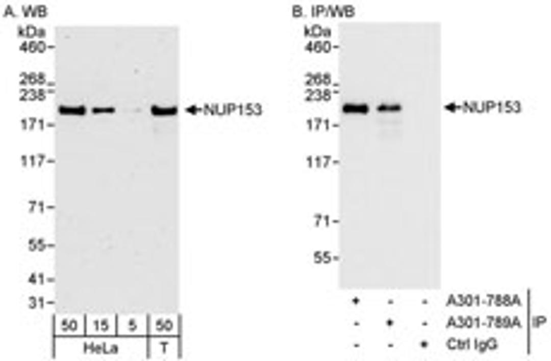 Detection of human NUP153 by western blot and immunoprecipitation.