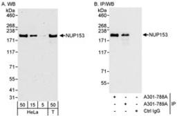 Detection of human NUP153 by western blot and immunoprecipitation.