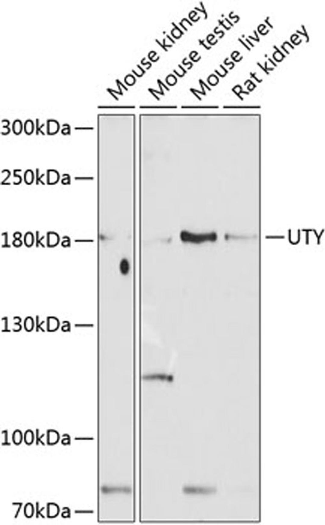 Western blot - UTY antibody (A8563)