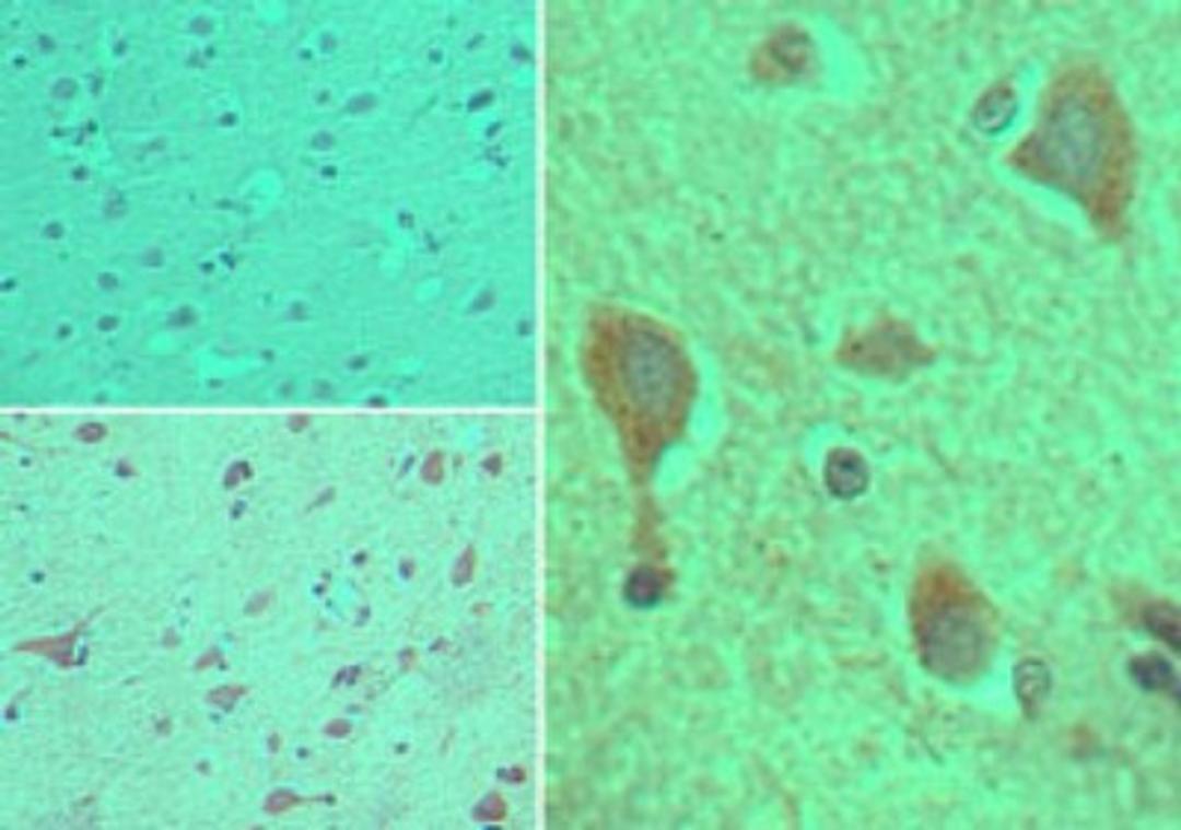 Immunohistochemistry-Paraffin: CYP1B1 Antibody [NBP2-24722] - Analysis of CYP1B1 in formalin-fixed, paraffin-embedded human brain tissue using an isotype control (top left) and this antibody (bottom left, right) at 5 ug/ml.