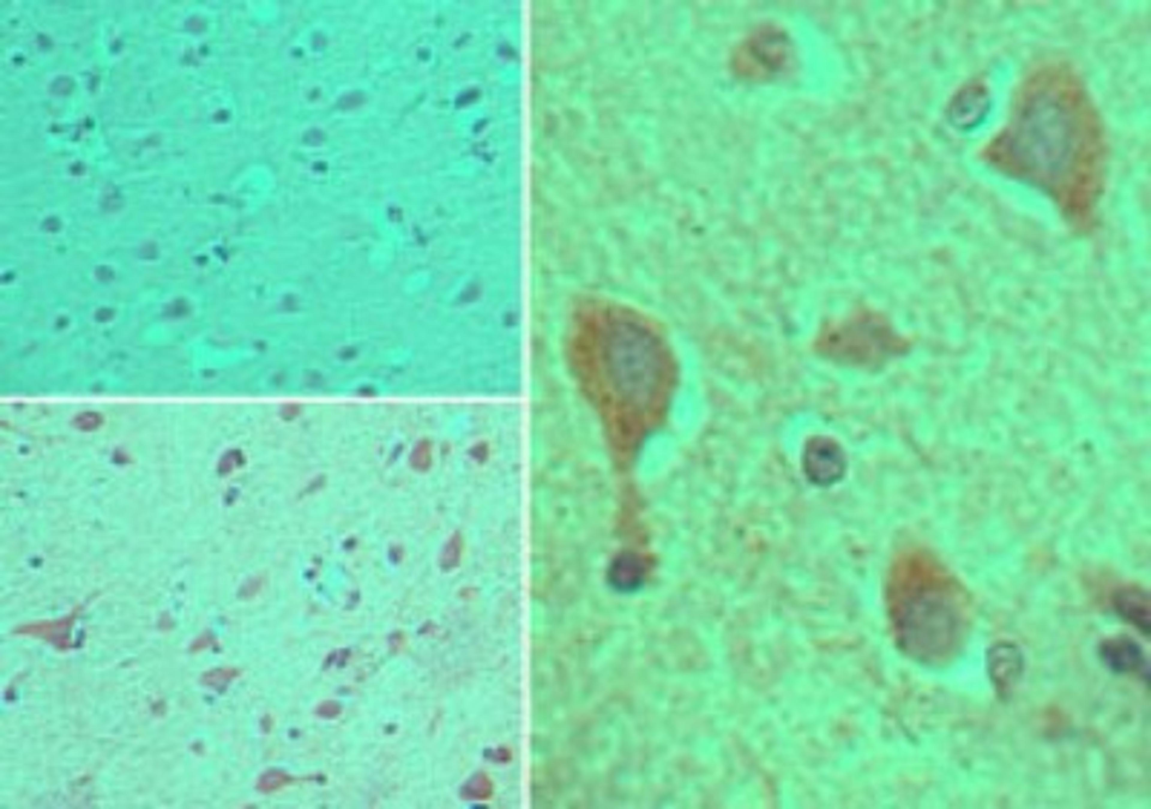 Immunohistochemistry-Paraffin: CYP1B1 Antibody [NBP2-24722] - Analysis of CYP1B1 in formalin-fixed, paraffin-embedded human brain tissue using an isotype control (top left) and this antibody (bottom left, right) at 5 ug/ml.