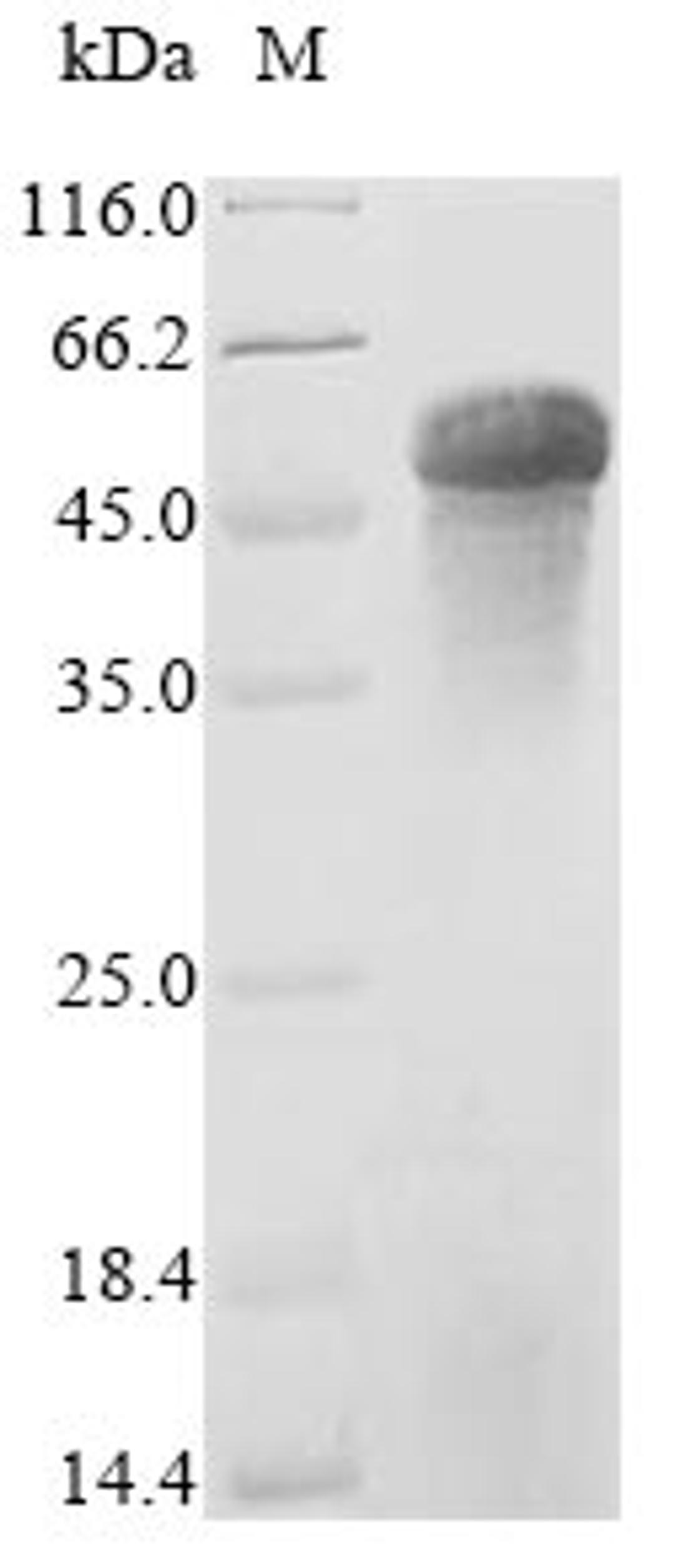 (Tris-Glycine gel) Discontinuous SDS-PAGE (reduced) with 5% enrichment gel and 15% separation gel.