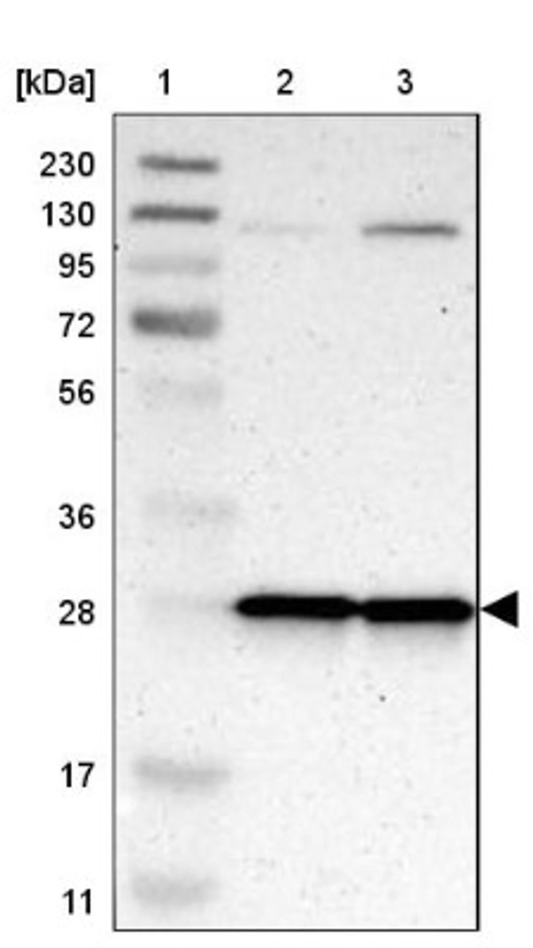 Western Blot: MRPL9 Antibody [NBP1-89561] - Lane 1: Marker [kDa] 230, 130, 95, 72, 56, 36, 28, 17, 11<br/>Lane 2: Human cell line RT-4<br/>Lane 3: Human cell line U-251MG sp