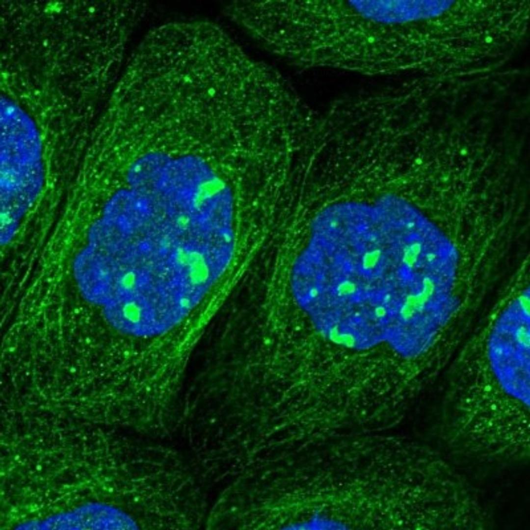 Immunocytochemistry/Immunofluorescence: COMMD3 Antibody [NBP1-88519] - Staining of human cell line A-431 shows positivity in nucleoli & cytoskeleton (microtubules).