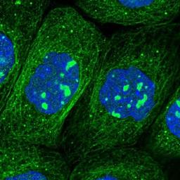 Immunocytochemistry/Immunofluorescence: COMMD3 Antibody [NBP1-88519] - Staining of human cell line A-431 shows positivity in nucleoli & cytoskeleton (microtubules).