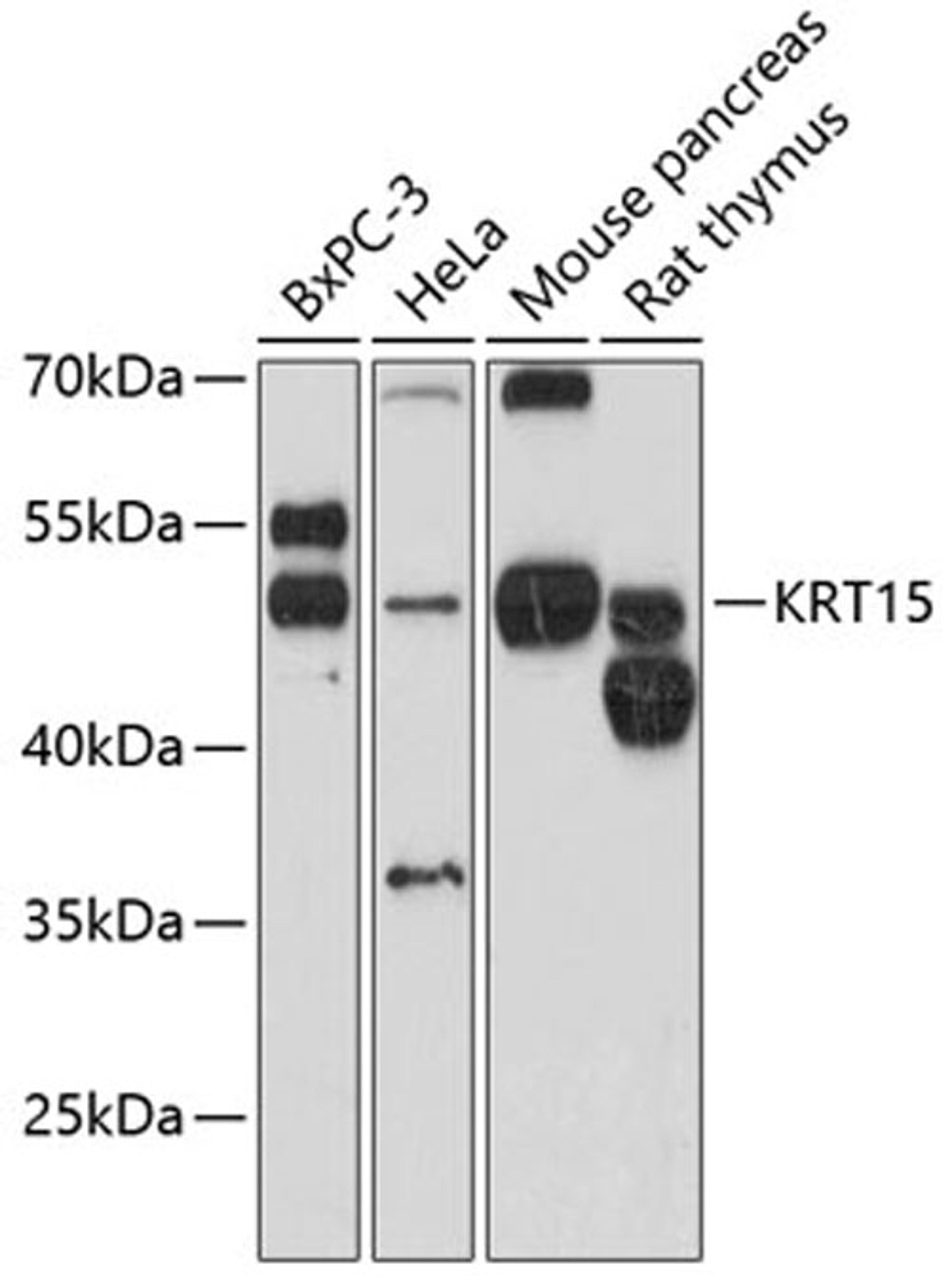 Western blot - KRT15 antibody (A12155)