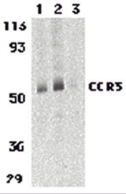 Western blot analysis of CCR3 in human spleen tissue lysates with CCR3 antibody at 1 (lane 1) and 2 &#956;g/mL (lane 2), and 2 &#956;g/mL in the presence of blocking peptide (lane 3).