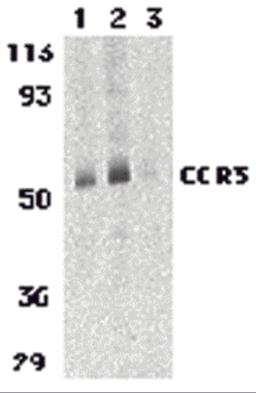 Western blot analysis of CCR3 in human spleen tissue lysates with CCR3 antibody at 1 (lane 1) and 2 μg/mL (lane 2), and 2 μg/mL in the presence of blocking peptide (lane 3).
