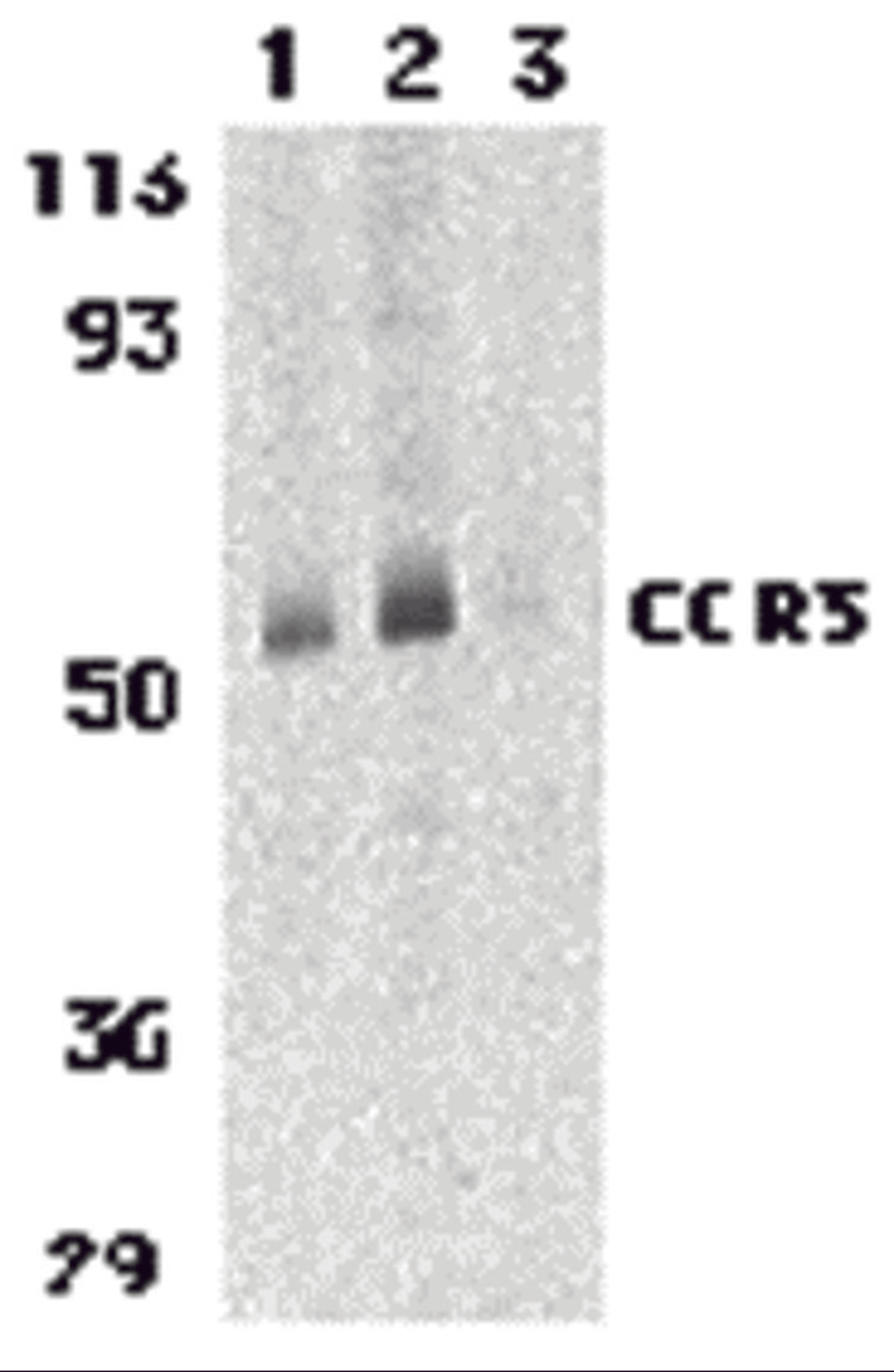 Western blot analysis of CCR3 in human spleen tissue lysates with CCR3 antibody at 1 (lane 1) and 2 μg/mL (lane 2), and 2 μg/mL in the presence of blocking peptide (lane 3).
