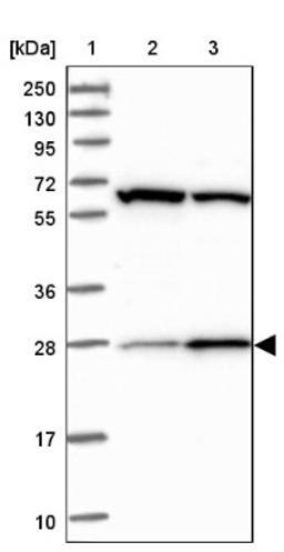 Western Blot: CEP27 Antibody [NBP1-89895] - Lane 1: Marker [kDa] 250, 130, 95, 72, 55, 36, 28, 17, 10<br/>Lane 2: Human cell line RT-4<br/>Lane 3: Human cell line U-251MG sp