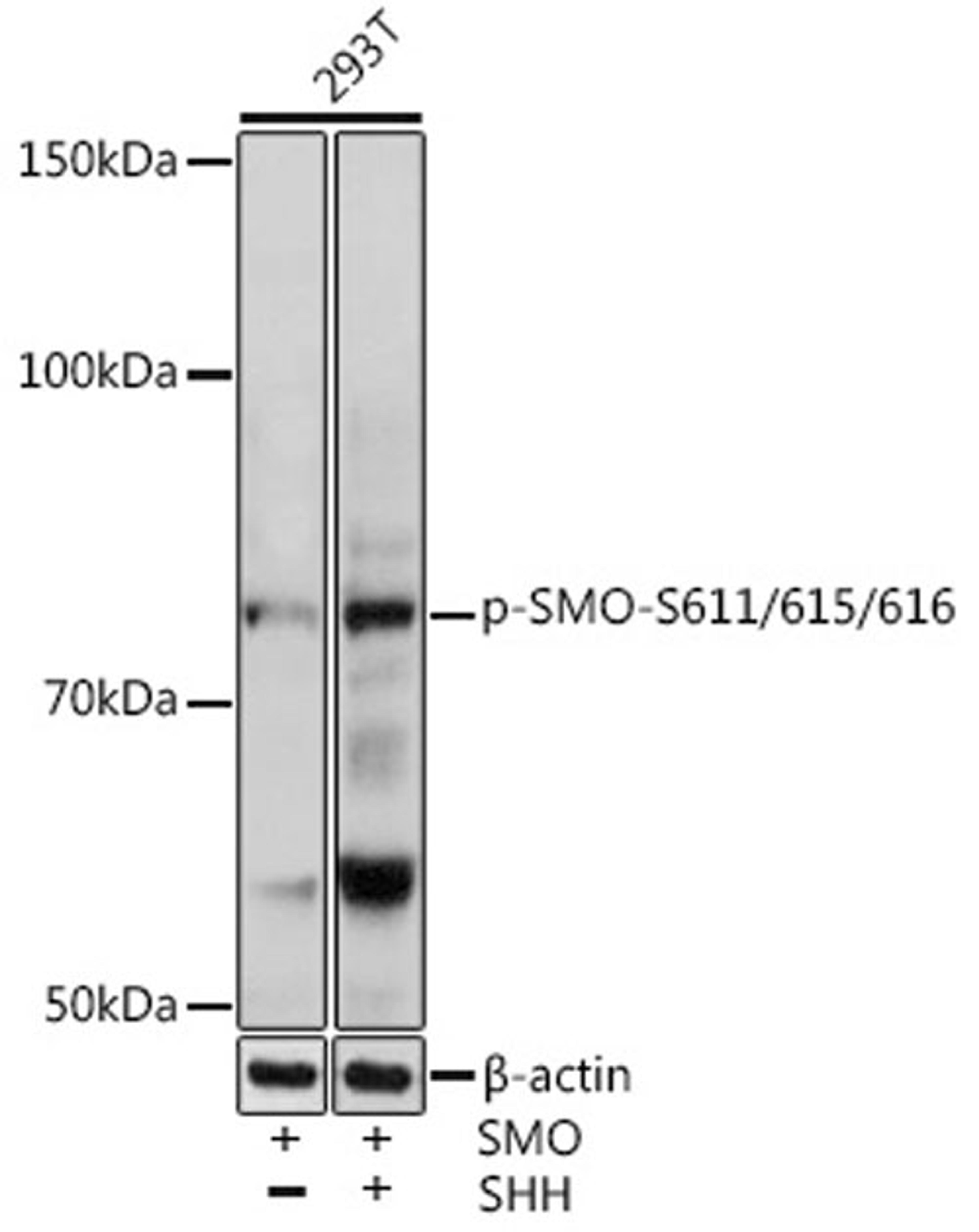 Western blot - Phospho-SMO-S611/615/616 antibody (AP0940)