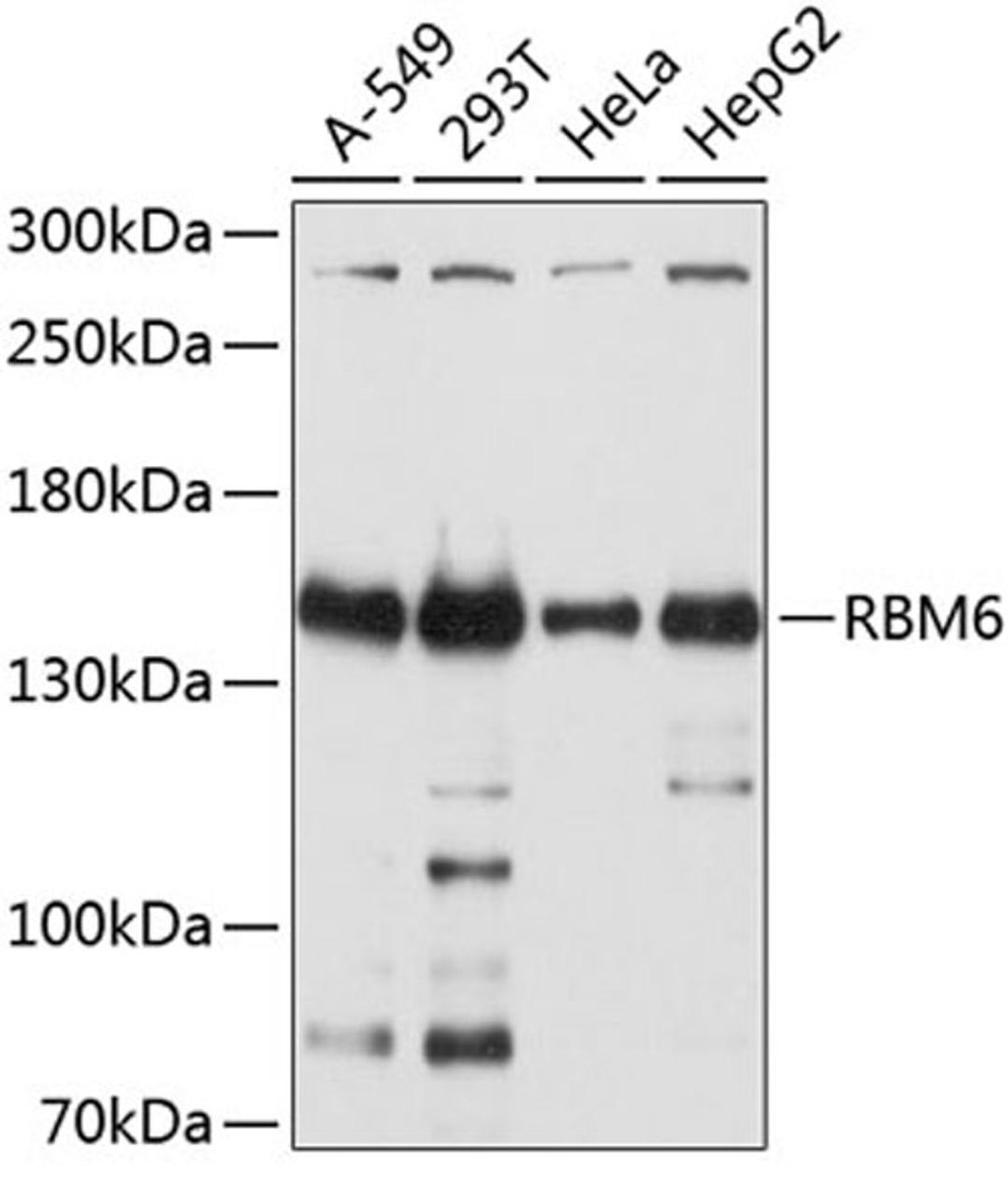 Western blot - RBM6 antibody (A10391)